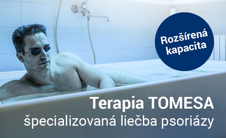 Tomesa - liečba psoriázy