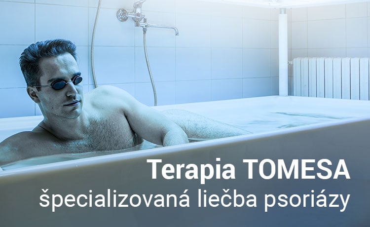 Tomesa - liečba psoriázy